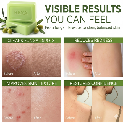 Rexa Antifungal Soap